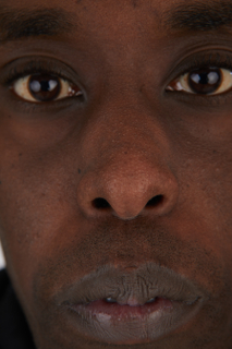 Photos of Deqavious Reese nose 0001.jpg